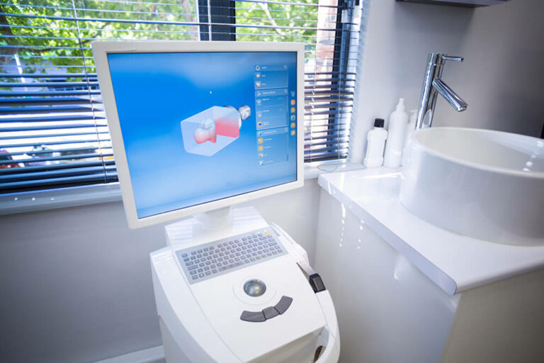 itero digital scanner machine in dental office